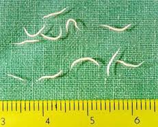 pinworms symptoms and treatment kids