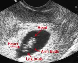 7 weeks pregnanyt ultrasound