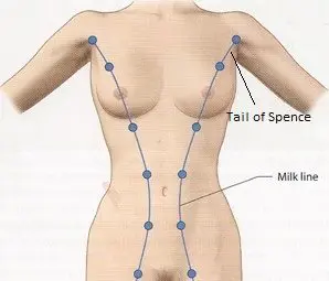 milk lines tail of spence lumps in armpits