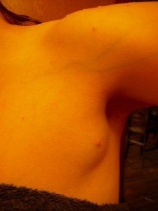 third boob third nipple armpit breastmilk