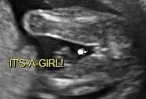 female ultrasound 3 lines