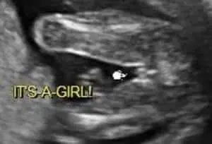 female ultrasound 3 lines