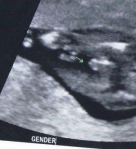 boy ultrasound 