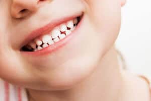 xylitol toddler dental health
