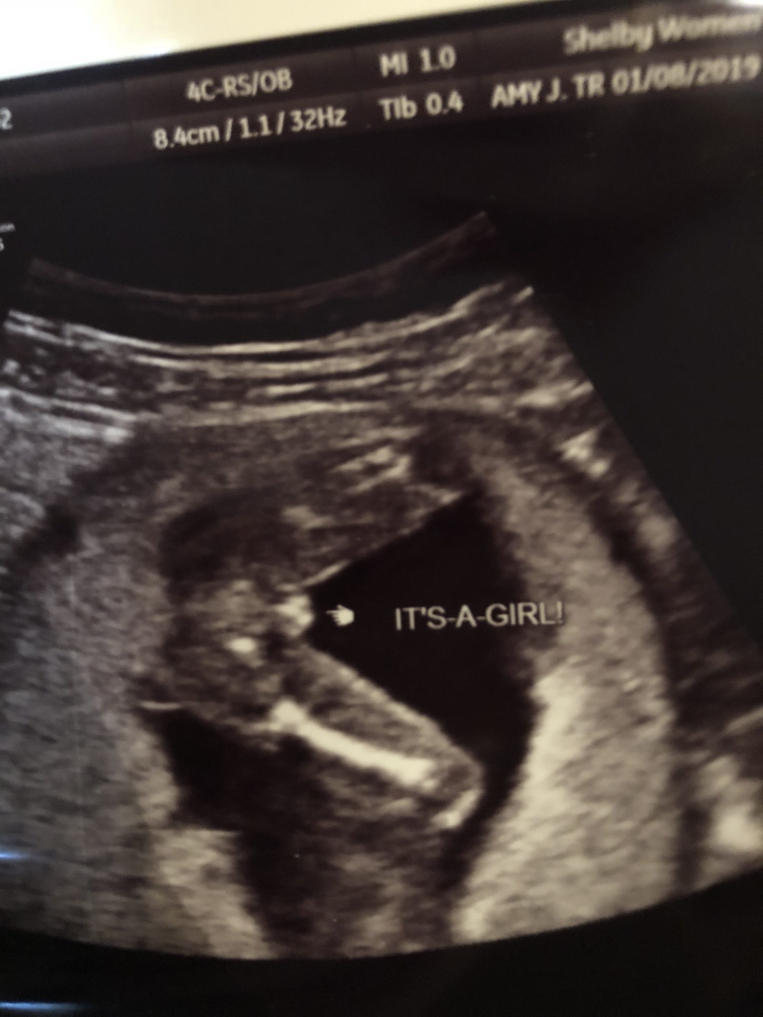Boy or Girl Ultrasound Wrong? Gender Scan Accuracy