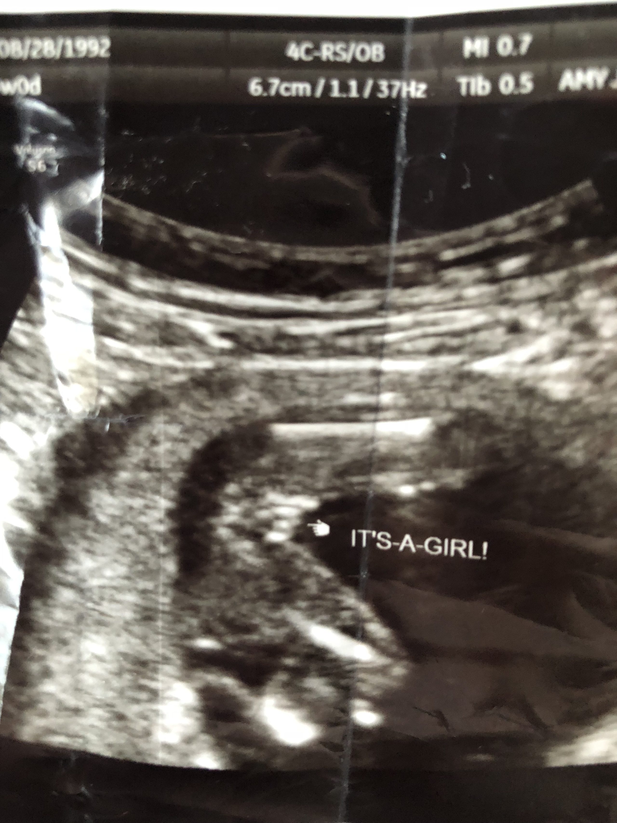 Boy or Girl Ultrasound Wrong? Gender Scan Accuracy